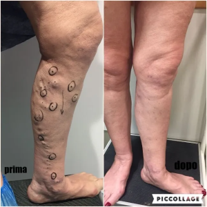 300x300_90_1_c_FFFFFF_0a72b4a4f8a31510cc3773b2690e5b2f