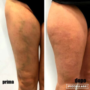 300x300_90_1_c_FFFFFF_20dfb0f8ee47a3f70ee294bdac713c77