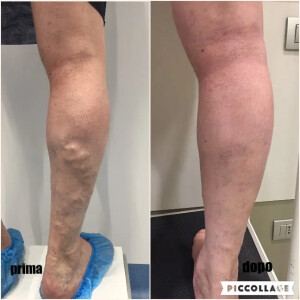 300x300_90_1_c_FFFFFF_68e8589c9c025b0ab07a37d5c6d30625