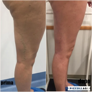 300x300_90_1_c_FFFFFF_cda544b8adcbeae72fd1ab23f8e63d04