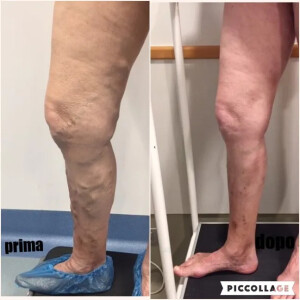 300x300_90_1_c_FFFFFF_de4be97ff97beb15242b910750af35e2